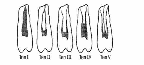 ������������ �������, �'��� ���� ��������� ������ � ������ ������