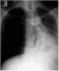 ������������� ���������� ���������������� ����������� �������������