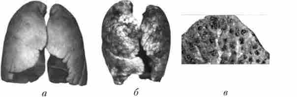 ���� ������ (�) � ����� (�). �������� ������ ����� (�)