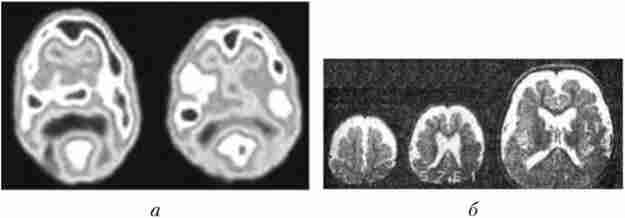 ������ ���������� ��������� �����