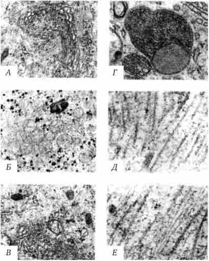 ��������������� ��������. ��������� ��. � �����