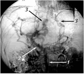 ��������� ������������ ���������