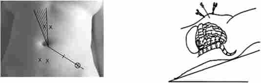 �������� �����