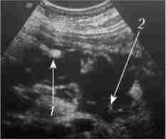 ������ ���������� ����� � ���������