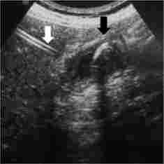 ���������� �������������� ��������������