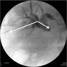 ���������� ������� ������� ������. �������� ���������� ���, ��������� ������ � ������ ���������� ��������