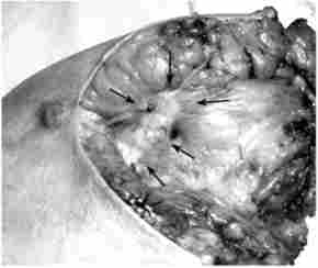 ������� ����� ��� - ���������� ��� ������� (��� ������� ������� ��������)