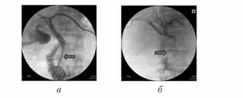 ���������-��������� ���������������� �������� ��������� �������� ������ �������. �������� ������� ��������� ������