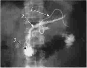 ���������-�������� ���������� ������� ���������� ������ (���������� ���������������)