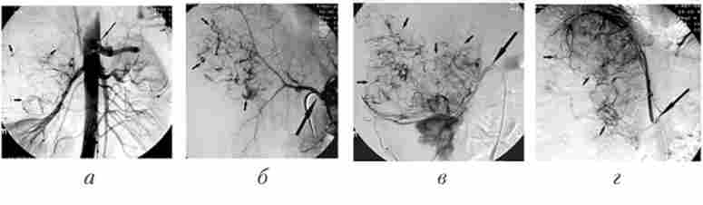 ��������� �������� � �������� ������� ����������, ��� �������� ����� ����� � ����� ������ �������