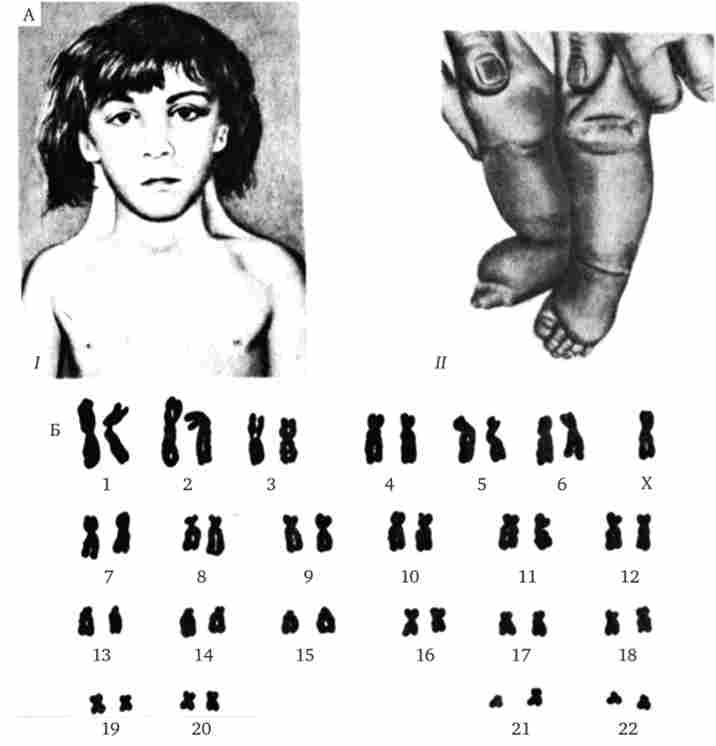 ������� ��������� X (��-�������, ������� ������������ - �������)