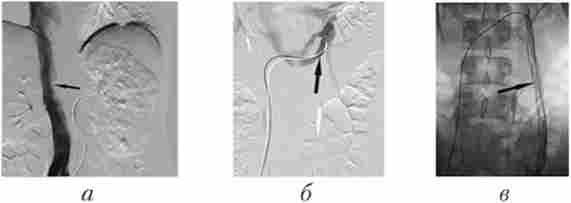 ����� ���������� � ���������� ��������� ��� ������� ����