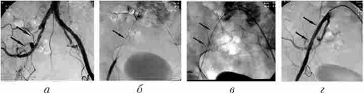 ������������ � ����������� ����� ��������� ������� �����