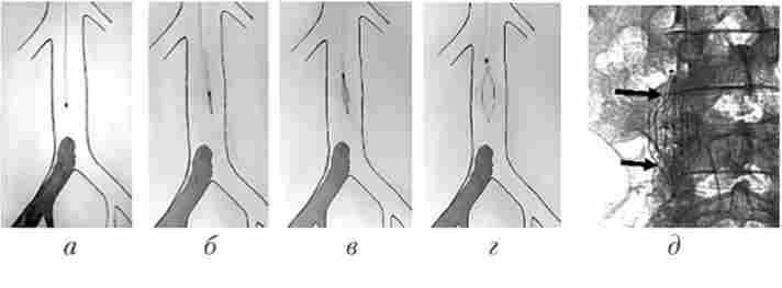 ����� ����������� ����-�������