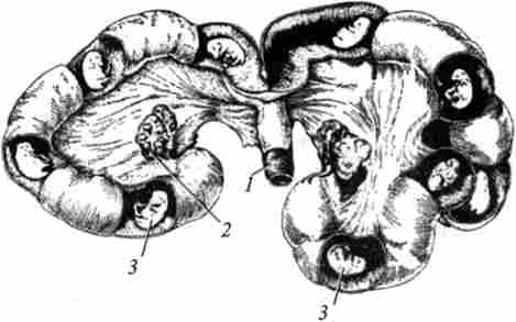 ������� ������� � ����� �����