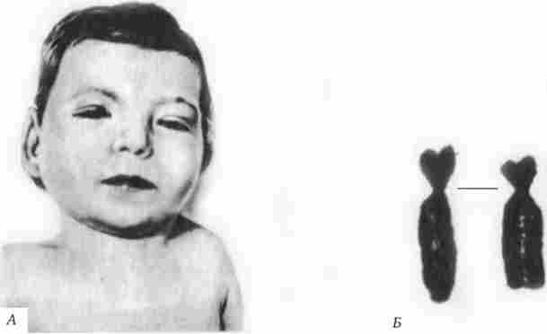 ������� ��������� 5� (������� ��������� �����)