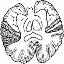 �������� �������� ������ �� ��������������� ����� ��������� ����� ������