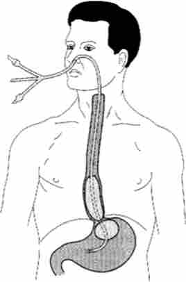 ����� ������������ �����-���������� ����������� - ���������