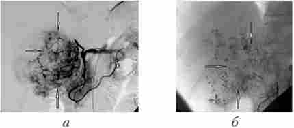 ������������� ������� ��������� ����� ������� (���������������� ���)