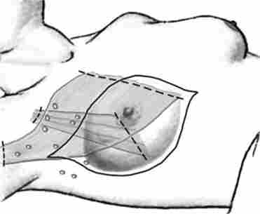 ����� ���������� ��������쳿 �� �������� - ������