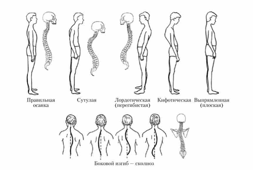 ������� � ����������� ������