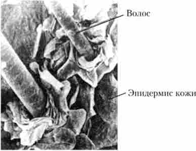 ����� (���������� �������� ���������)