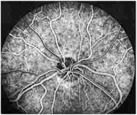 ������ ������ ���