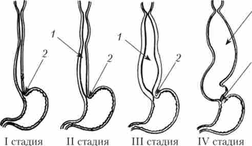 ����� ������������� ��� ��� I-IV ������