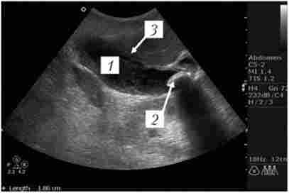 ������������� ���������� �������� �����������