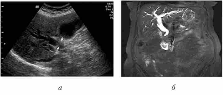 ������� �������� ������ �������