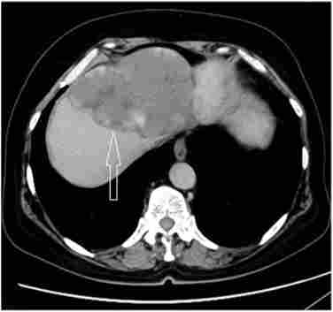 ��-������� ��� ��������� �������. ³���������� ��������� ����� - ���������. ������� ������� �������