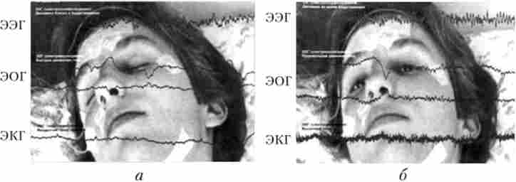 ������������� ��������� (���, ���, ���), ������������ � ������ � ����� ��� (�) � �������� (�)