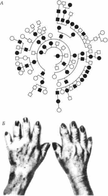 ������ (X) ��� ���������-����������� ��� ������������ (���- �������� - �)