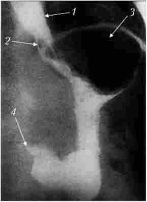 �������� �����������-���������� �������� ��� ���� ����������� ����� ������