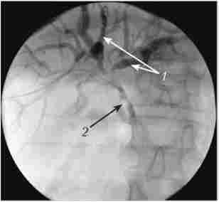 ���������� ���������������������������