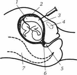 ������ ��������� �������� ��� ����������� ����������