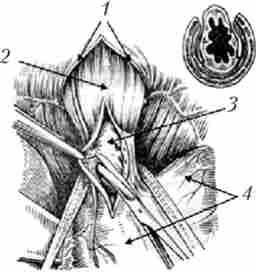 ����������������쳿 �� �������. ���� �������� ������� �������� �� �'������� ���� ���������� � ���䳿