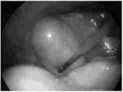 �����������. ��������� ���������� ������� ����