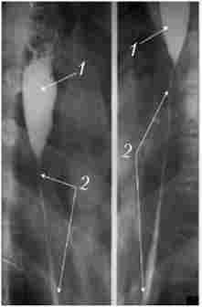 ������������� ���������� ��� ���� ������������ �������� ��������