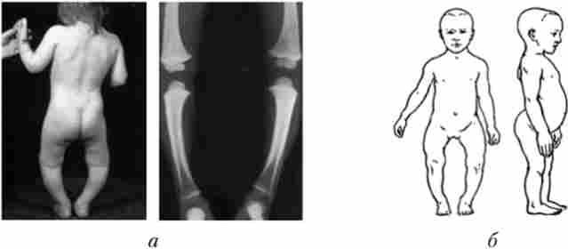 ���� ������� ��� �����