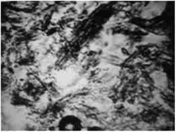 ����� ������� ���������� ������ ���� ����� 5 �� ���� �������� 15% -���� ���� ���� � 3% -���� ������� NaOCI, ����������� ����, ���������� 30 �. ̳�������, * 80