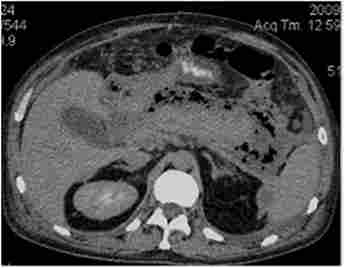 ��������� ���� � �������������� ���������