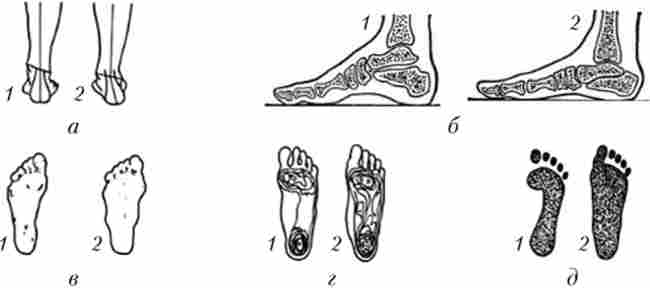 ����� ����� � ���� (1) � ��� ������������� (2)