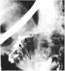 ����������� ��������������� ��� ���������� ����������