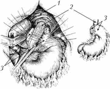 ������������ �� �������