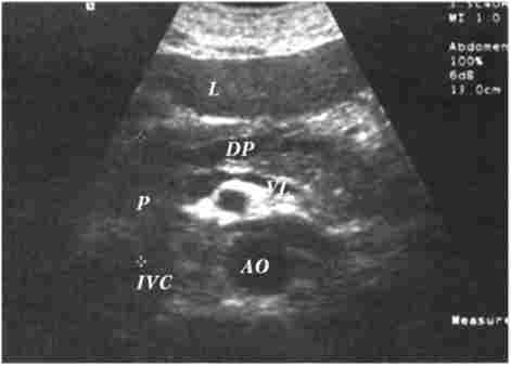 ������������� ���������� ��� ���������� ����������