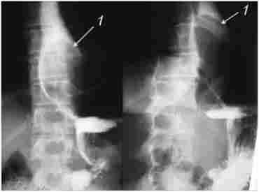 ������������� ���������� � ��������� � ���� �������� �������