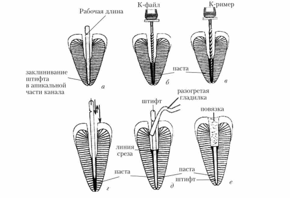 �������� ����������� ���������� ������ ������ �� ������������� ������ ������ [27]