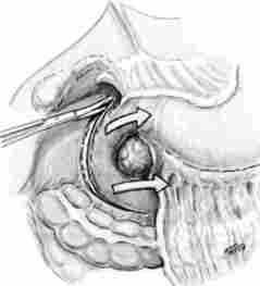 ��������� ��������� ��������� �� ���� �������������� �����