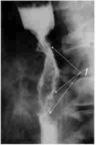 ������������� ��������� �������